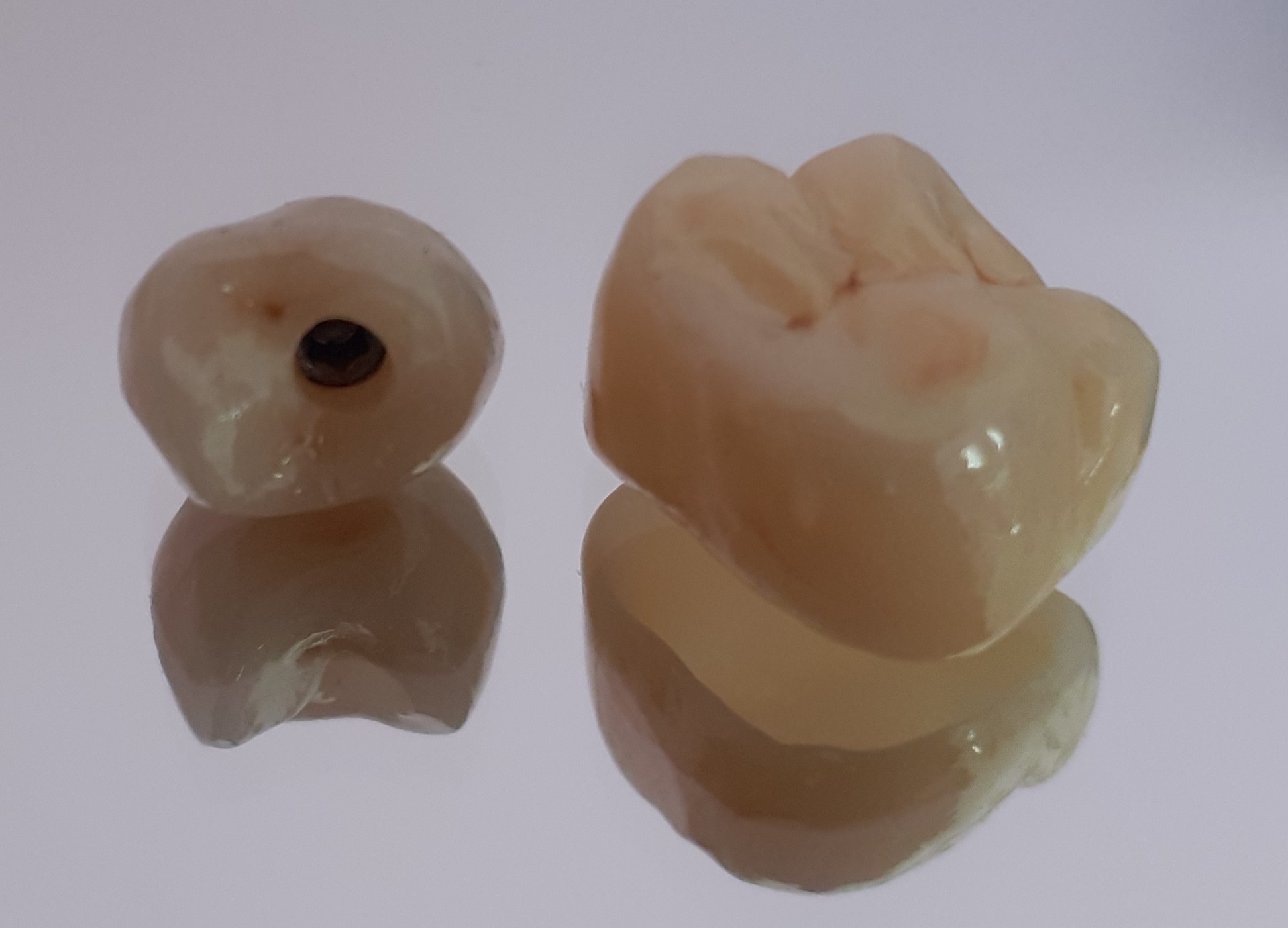 Ceramica integrale su denti e impianti