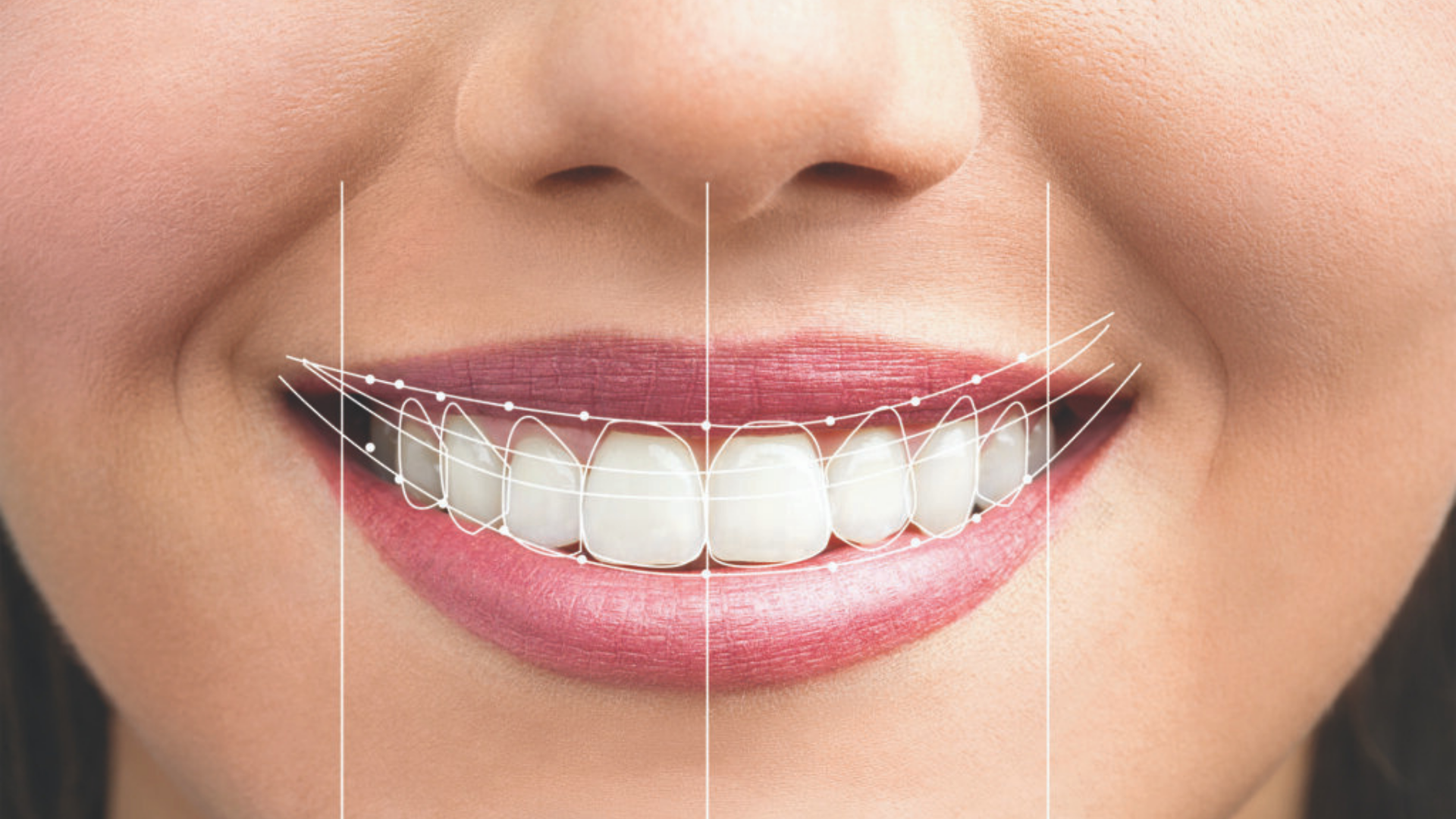 Digital Smile Design